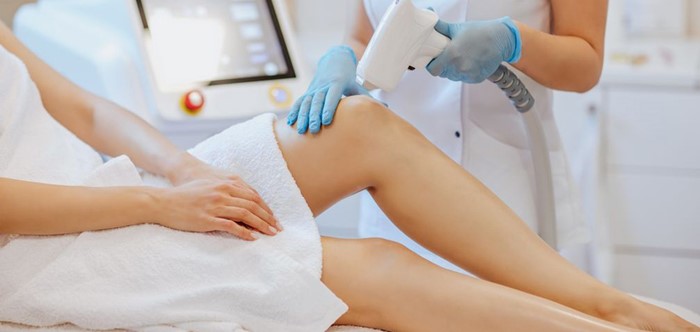 Laser Epilation