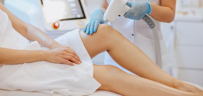 Laser Epilation
